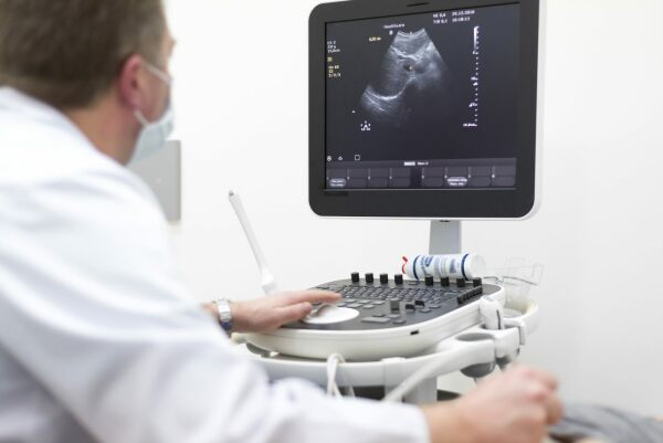ultrasound-trackball